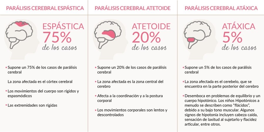 tipos-paralisis-cerebral